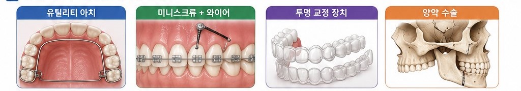 과개교합 07.jpg