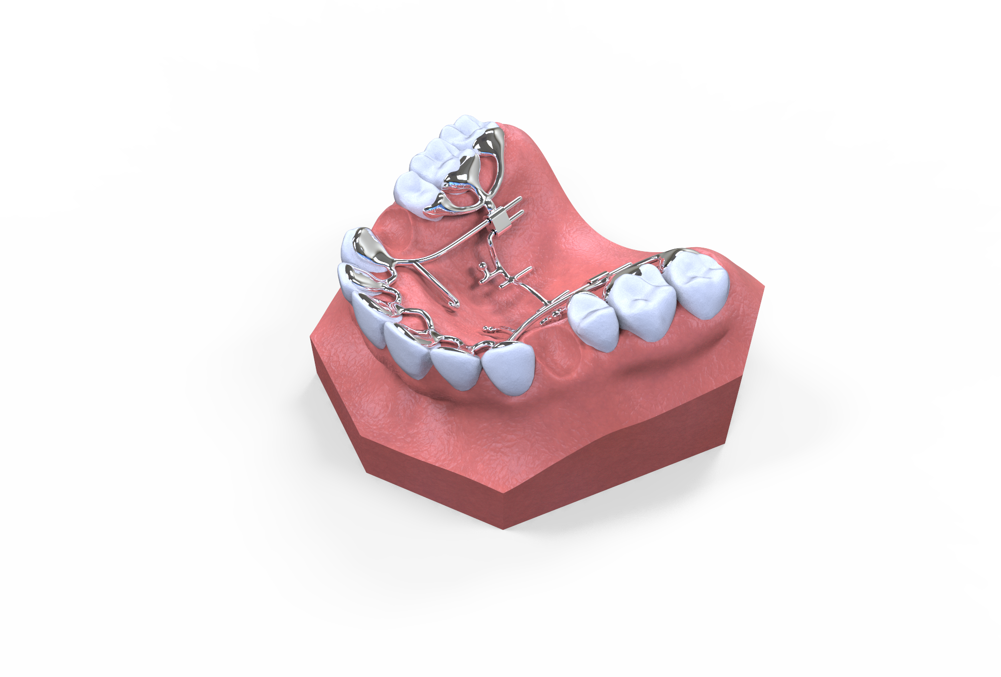 KILBON 교정장치 3D
