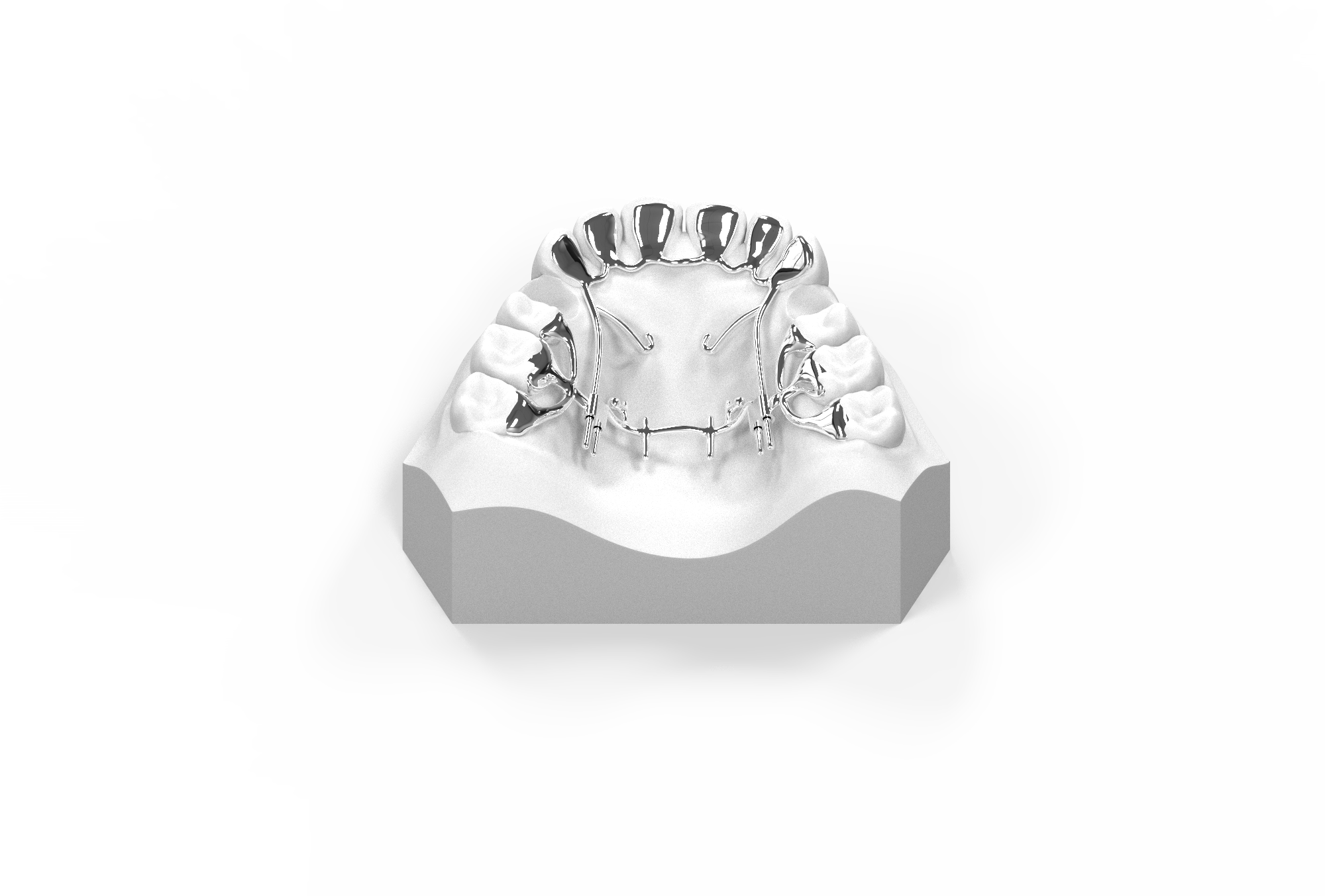 KILBON 교정장치 3D 모델 — 뷰 4