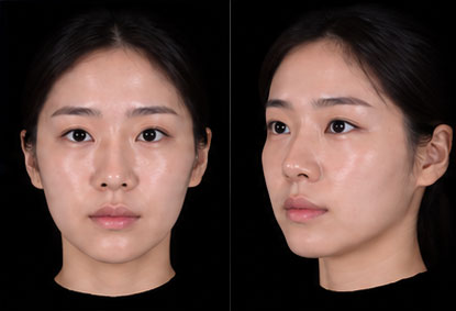 Morpheus 3D 안면 스캔 화면