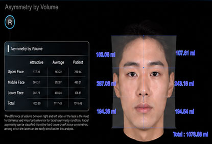 Morpheus 3D 안모 데이터 분석 화면