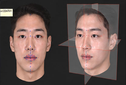 Morpheus 안모 기준점 분석 화면