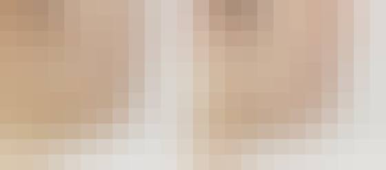 킬본교정 : 돌출입 (회원 전용)